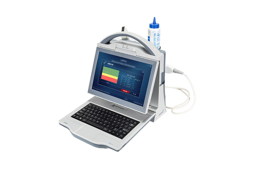 便攜式骨密度檢測(cè)儀 BMD-A3